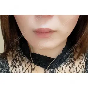 BiBiクリニック口コミ