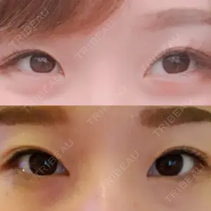 口コミ