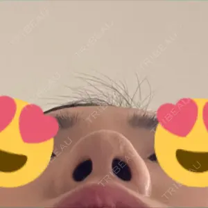 LUHO（ルホ）美容外科口コミ