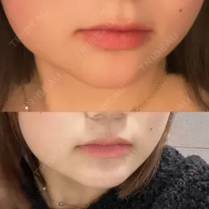 フォンタナクリニック天神口コミ