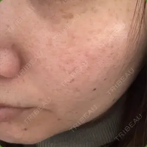B-LINE CLINIC B-LINE CLINIC 池袋院口コミ