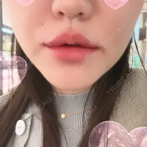 口コミ