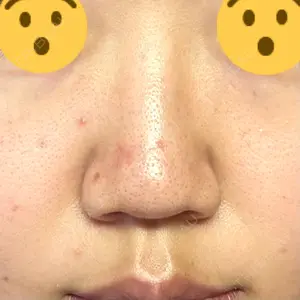 口コミ