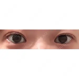 東京シンデレラ美容外科 東京シンデレラ美容外科 池袋院口コミ