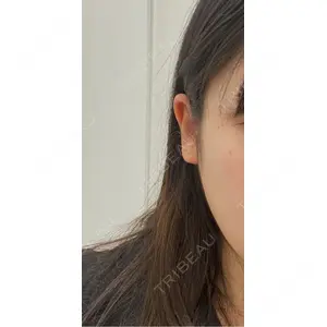 TCB東京中央美容外科 TCB東京中央美容外科 池袋駅前院口コミ