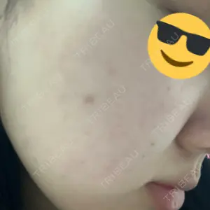 DAILY SKIN CLINIC DAILY SKIN CLINIC 福岡院口コミ