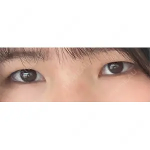 口コミ