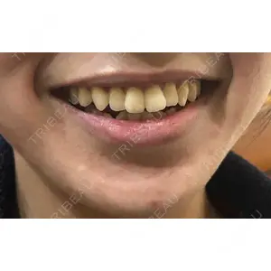 口コミ