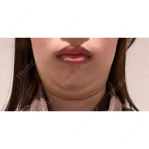 口コミ