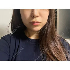 BLINC CLINIC （ブリンク クリニック）口コミ