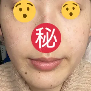 口コミ