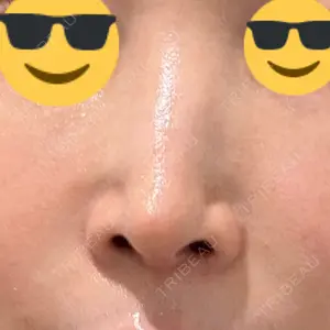 銀座マイアミ美容外科口コミ