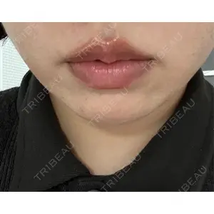 新宿Ladies&Gentlemen美容クリニック口コミ