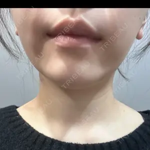 L‘amour clinic Tokyo【ラムールクリニック東京】口コミ