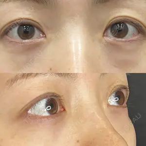 藤・ナチュレ美容クリニック 藤・ナチュレ美容クリニック 銀座院口コミ