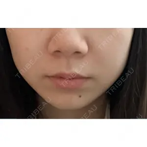 ルラ美容クリニック ルラ美容クリニック 町田院口コミ