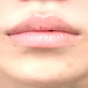 PRO CLINIC プロクリニック 銀座院口コミ