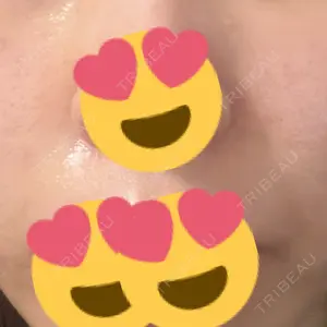 BiBiクリニック口コミ