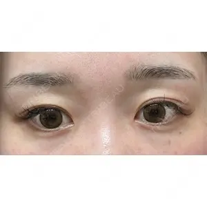LUHO（ルホ）美容外科口コミ