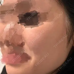DAILY SKIN CLINIC DAILY SKIN CLINIC 心斎橋院口コミ