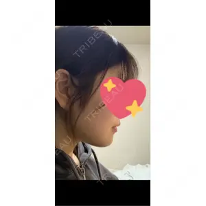 AVAN TOKYO 銀座脂肪吸引 クリニックの