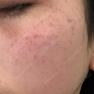 ルラ美容クリニック ルラ美容クリニック 静岡院口コミ