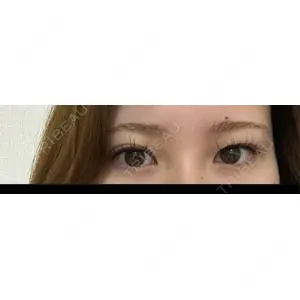 HAAB×DREAM BEAUTY CLINIC HAAB×DREAM BEAUTY CLINIC 東京本院口コミ