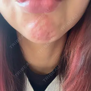 口コミ