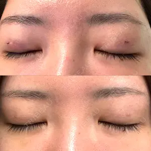 9BeautyClinic口コミ
