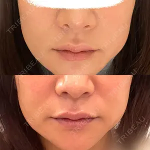 EMMO FACE CLINIC 東京三田院口コミ