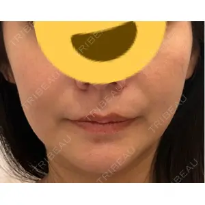 新宿ラクル美容外科クリニック 六本木院の