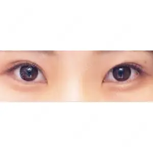 HAAB×DREAM BEAUTY CLINIC HAAB×DREAM BEAUTY CLINIC 大阪梅田院口コミ