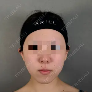 アリエル美容クリニック アリエル美容クリニック 大宮院口コミ