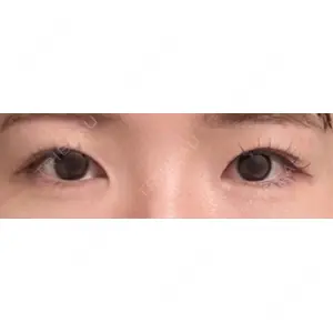 口コミ