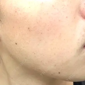 CZEN CLINIC 銀座院口コミ