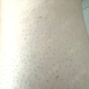 口コミ