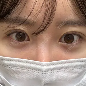 口コミ