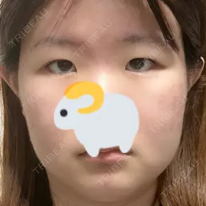 口コミ