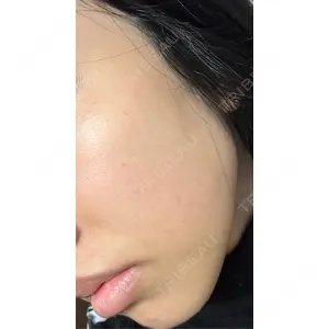 CZEN CLINIC 銀座院口コミ