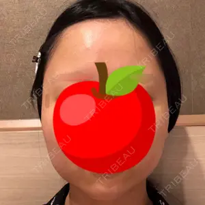 クッキー整形外科の