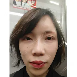 新宿美容外科クリニック 新宿美容外科クリニック 新宿院口コミ