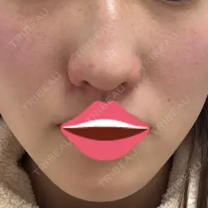 大塚美容形成外科の口コミ