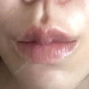 ルラ美容クリニック ルラ美容クリニック 名古屋本院口コミ