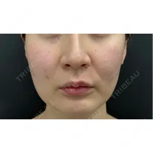 BLINC CLINIC （ブリンク クリニック）口コミ