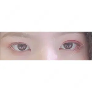 グロービー美容整形外科口コミ