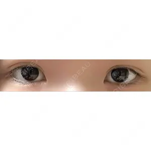 東京イセアクリニック口コミ