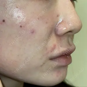 ルラ美容クリニック ルラ美容クリニック 新宿院口コミ