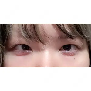 LUHO（ルホ）美容外科口コミ