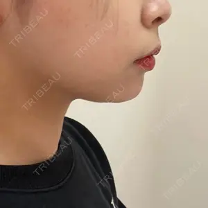 口コミ