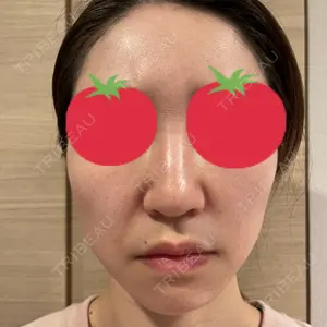 HINATA クリニック口コミ